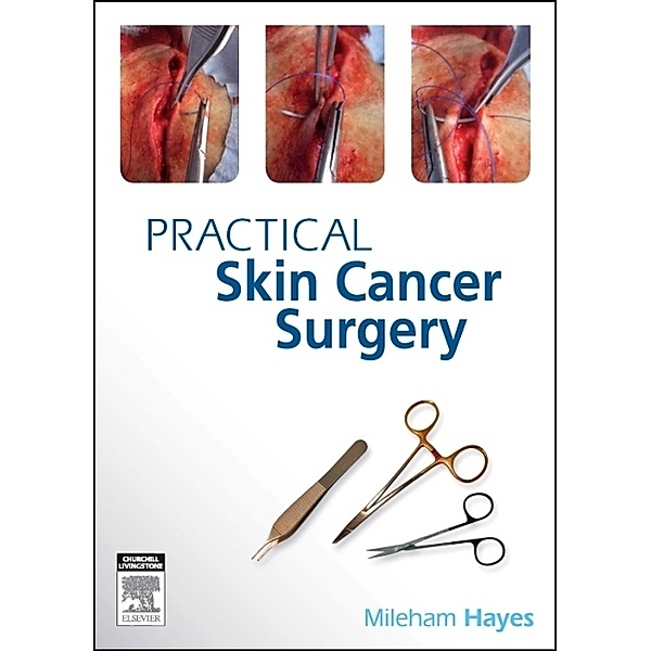 Practical Skin Cancer Surgery, Mileham Hayes