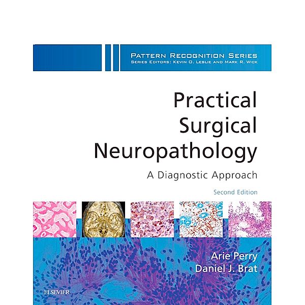 Practical Surgical Neuropathology: A Diagnostic Approach E-Book, Arie Perry, Daniel J. Brat