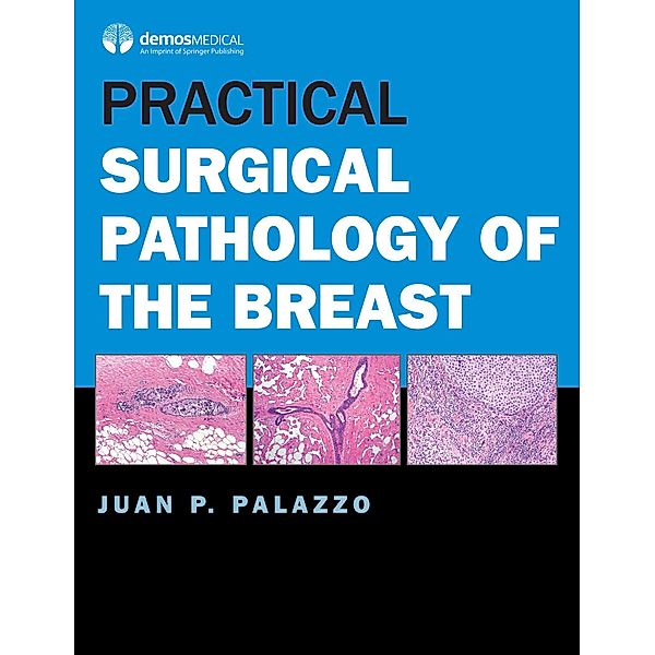 Practical Surgical Pathology of the Breast, Juan P. Palazzo