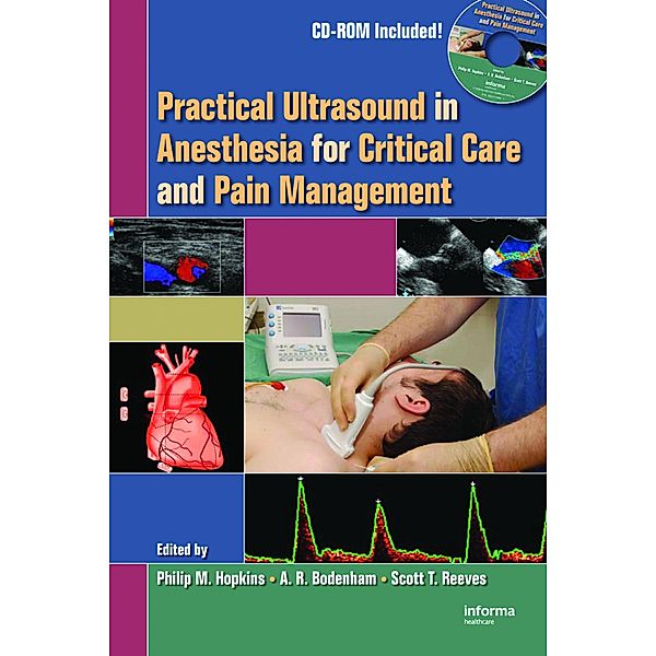 Practical Ultrasound in Anesthesia for Critical Care and Pain Management