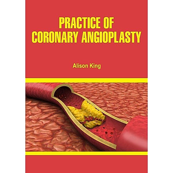 Practice of Coronary Angioplasty, Alison King