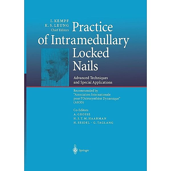 Practice of Intramedullary Locked Nails