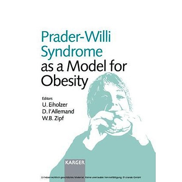 Prader-Willi Syndrome as a Model for Obesity