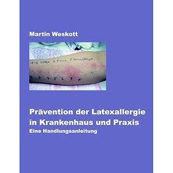 Prävention der Latexallergie in Krankenhaus und Praxis, Martin Weskott