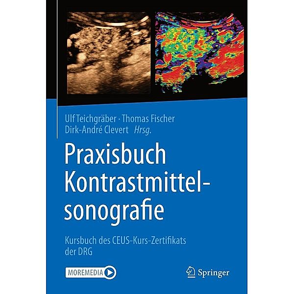 Praxisbuch Kontrastmittelsonografie