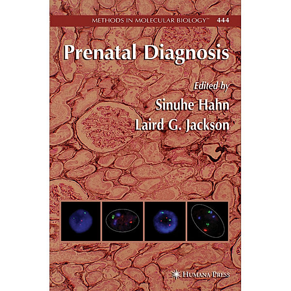 Prenatal Diagnosis