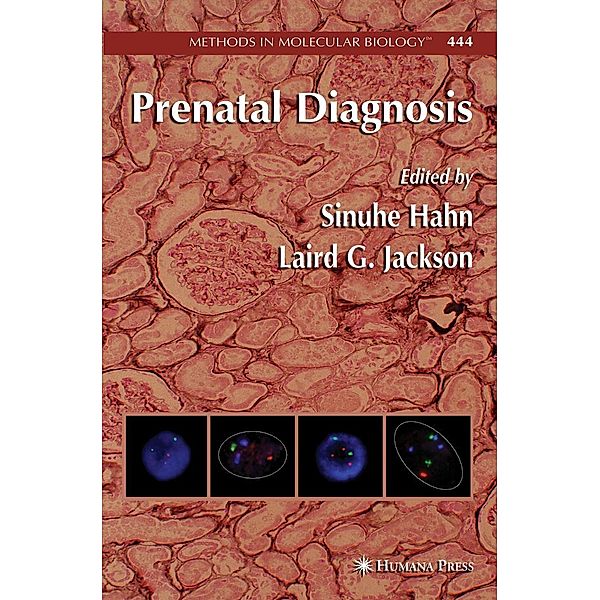 Prenatal Diagnosis / Methods in Molecular Biology Bd.444