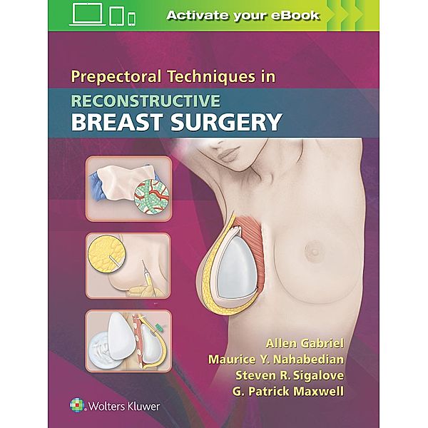 Prepectoral Techniques in Reconstructive Breast Surgery