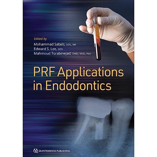 PRF Applications in Endodontics, Mohammad Sabeti, Edward S Lee, Mahmoud Torabinejad