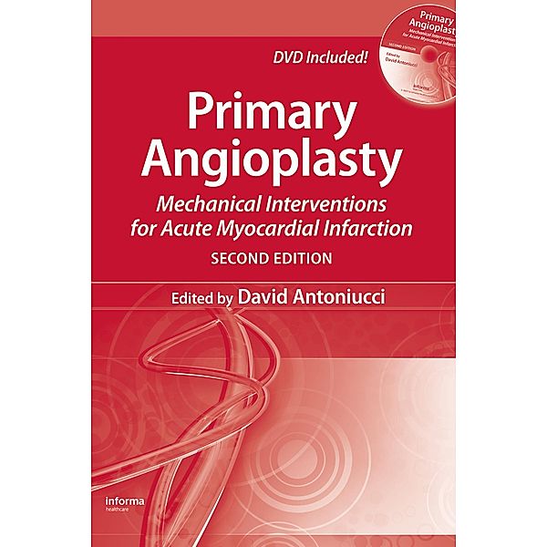 Primary Angioplasty