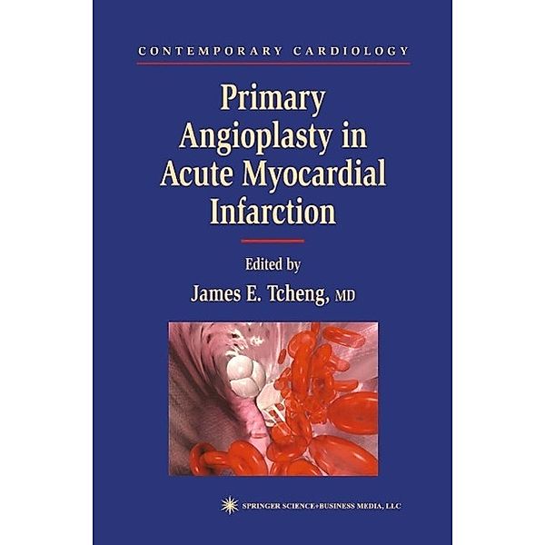 Primary Angioplasty in Acute Myocardial Infarction / Contemporary Cardiology