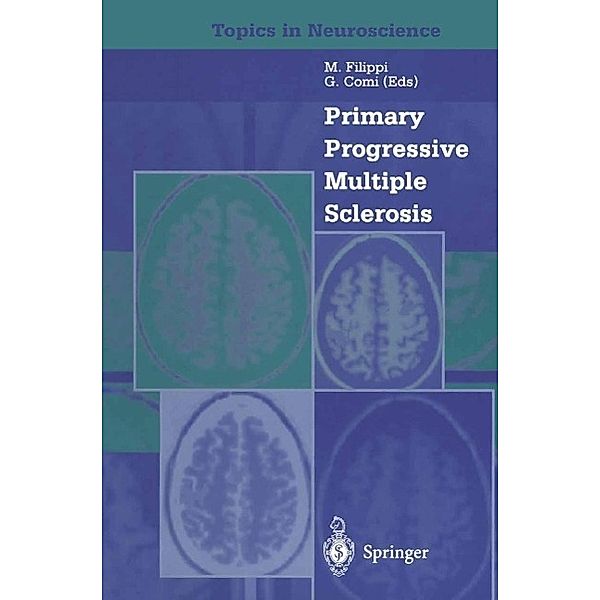 Primary Progressive Multiple Sclerosis / Topics in Neuroscience