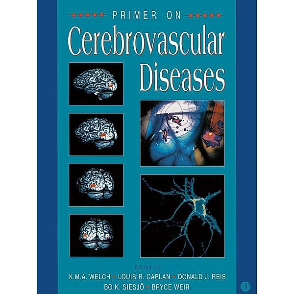 Primer on Cerebrovascular Diseases