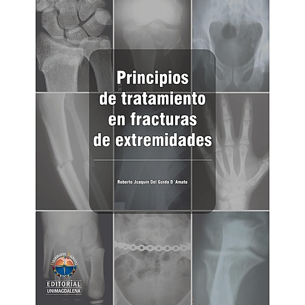 Principios de tratamiento en fracturas de extremidades, Roberto Joaquín Gordo Del D´Amato, Fabián Gerardo Castillo Suárez