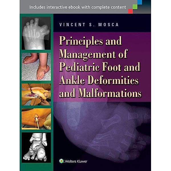 Principles and Management of Pediatric Foot and Ankle Deformities and Malformations, Vincent S. Mosca
