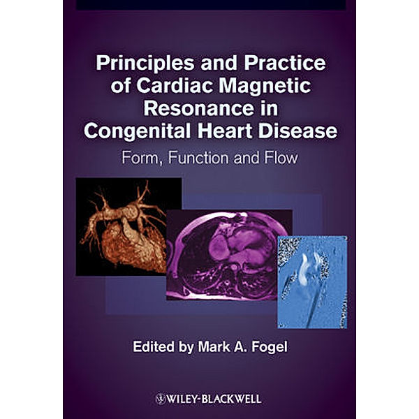 Principles and Practice of Cardiac Magnetic Resonance in Congenital Heart Disease, Mark A. Fogel