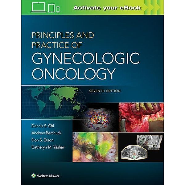 Principles and Practice of Gynecologic Oncology, Dennis Chi, Andrew Berchuck, Don S. Dizon, Catheryn M. Yashar