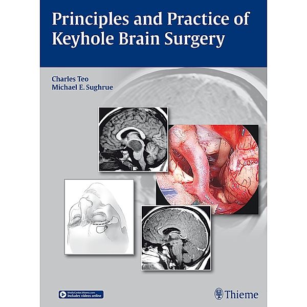 Principles and Practice of Keyhole Brain Surgery, Charles Teo, Michael E. Sughrue