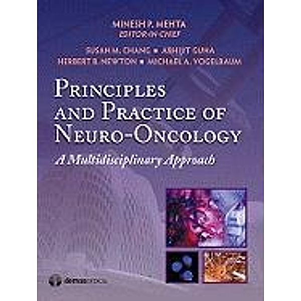 Principles and Practice of Neuro-Oncology: A Multidisciplinary Approach, Minesh P. Mehta, Susan M. Chang, Michael A. Vogelbaum, Abhijit Guha