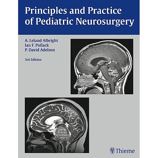 Principles and Practice of Pediatric Neurosurgery, A. Leland Albright, Ian F. Pollack, P. D. Adelson