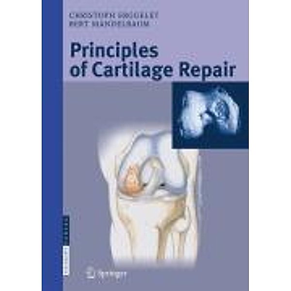 Principles of Cartilage Repair, Christoph Erggelet, Bert R. Mandelbaum