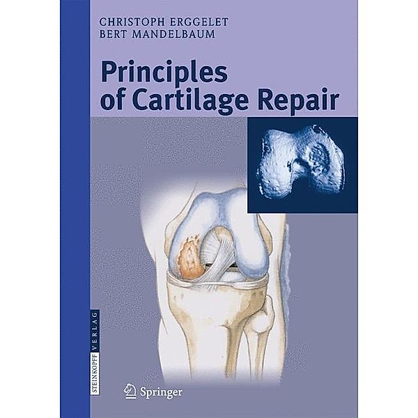 Principles of Cartilage Repair, Christoph Erggelet, Bert R. Mandelbaum