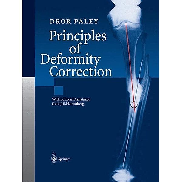 Principles of Deformity Correction, Dror Paley