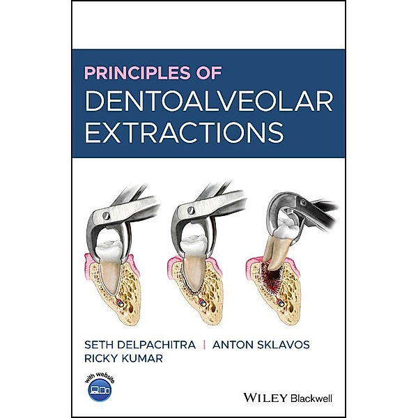 Principles of Dentoalveolar Extractions, Seth Delpachitra, Anton Sklavos, Ricky Kumar