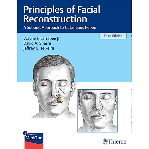 Principles of Facial Reconstruction, Wayne F. Larrabee, David A. Sherris, Jeffrey Teixeira