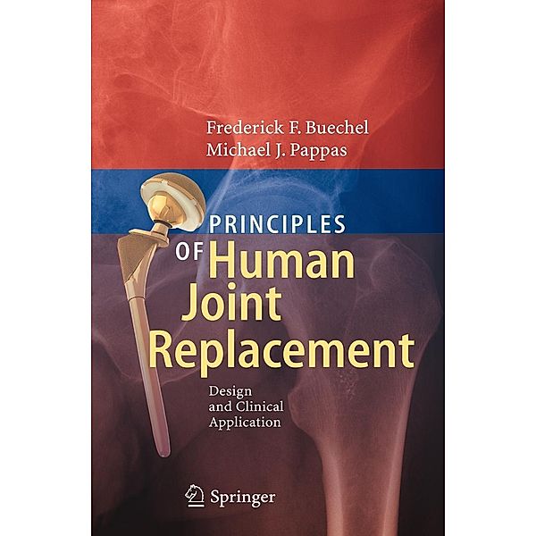 Principles of Human Joint Replacement, Frederick F. Buechel, Michael J. Pappas