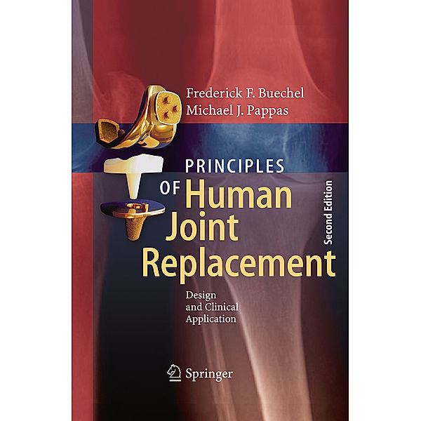 Principles of Human Joint Replacement, Frederick F. Buechel, Michael J. Pappas