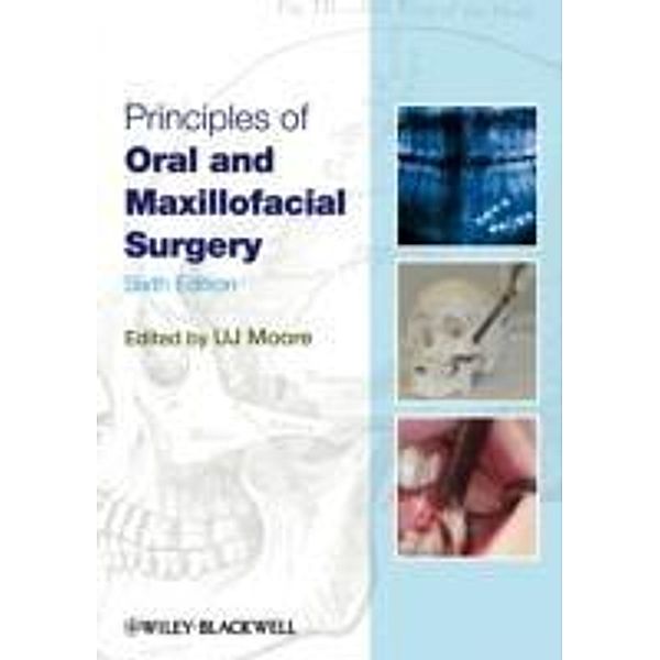 Principles of Oral and Maxillofacial Surgery, U. J. Moore