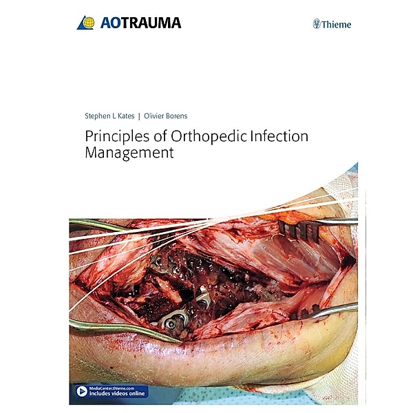 Principles of Orthopedic Infection Management, Stephen Kates, Olivier Borens