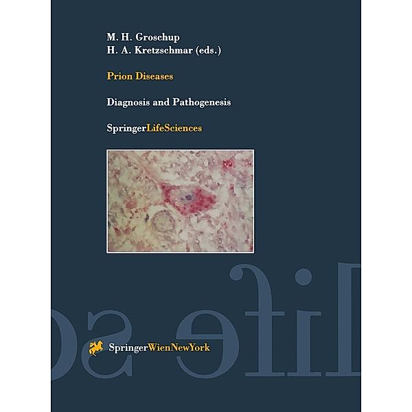 Prion Diseases / Archives of Virology. Supplementa Bd.16