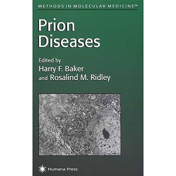 Prion Diseases / Methods in Molecular Medicine Bd.3