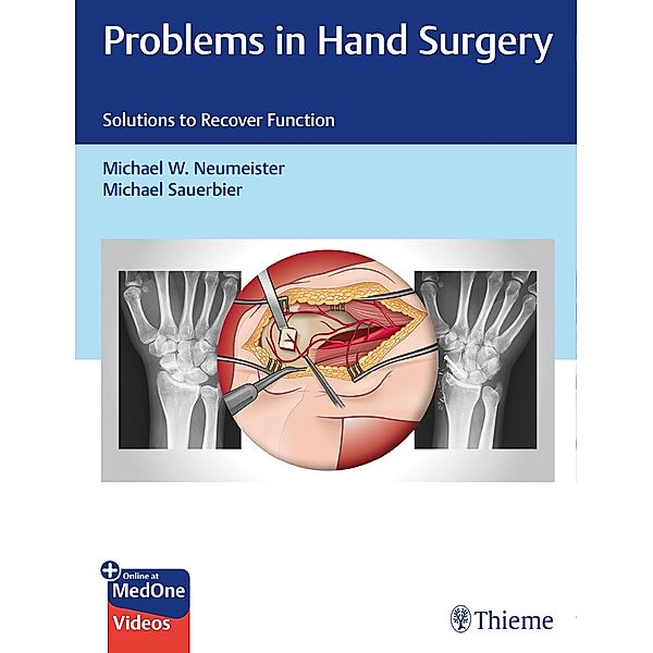 Problems in Hand Surgery