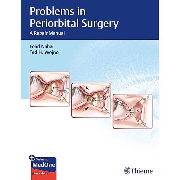 Problems in Periorbital Surgery, Foad Nahai, Ted H. Wojno