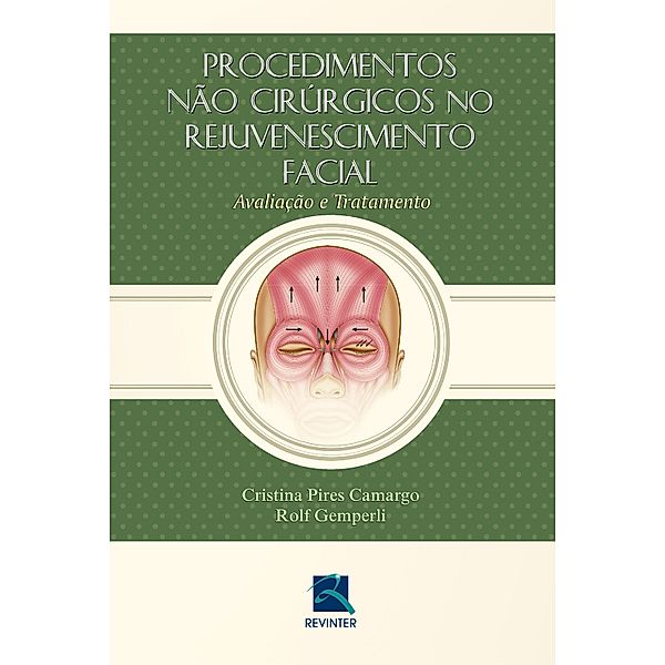Procedimentos não Cirúrgicos no Rejuvenescimento Facial, Rolf Gemperli, Cristina Pires Camargo