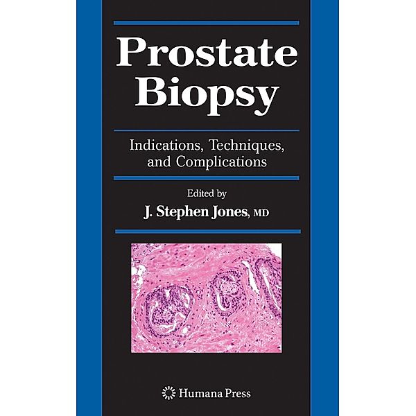 Prostate Biopsy / Current Clinical Urology