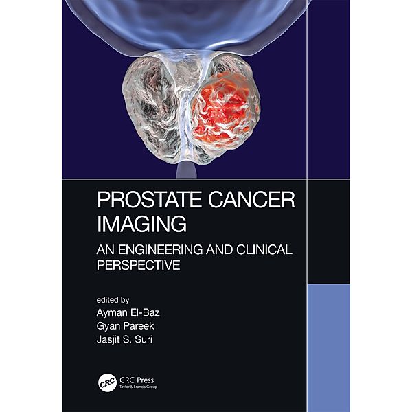 Prostate Cancer Imaging