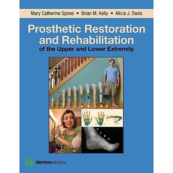 Prosthetic Restoration and Rehabilitation of the Upper and Lower Extremity, Alicia J. Davis, Brian M. Kelly, Mary Catherine Spires