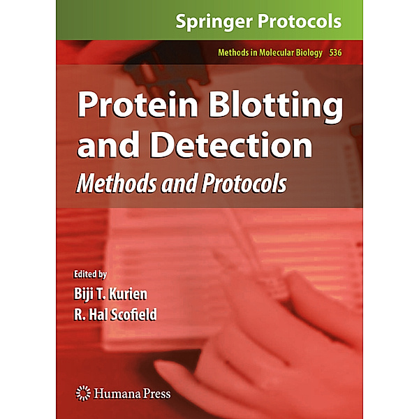 Protein Blotting and Detection