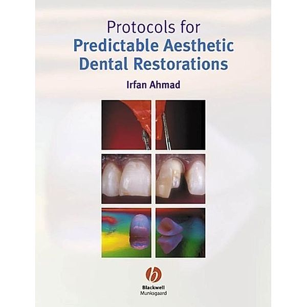 Protocols for Predictable Aesthetic Dental Restorations, Irfan Ahmad