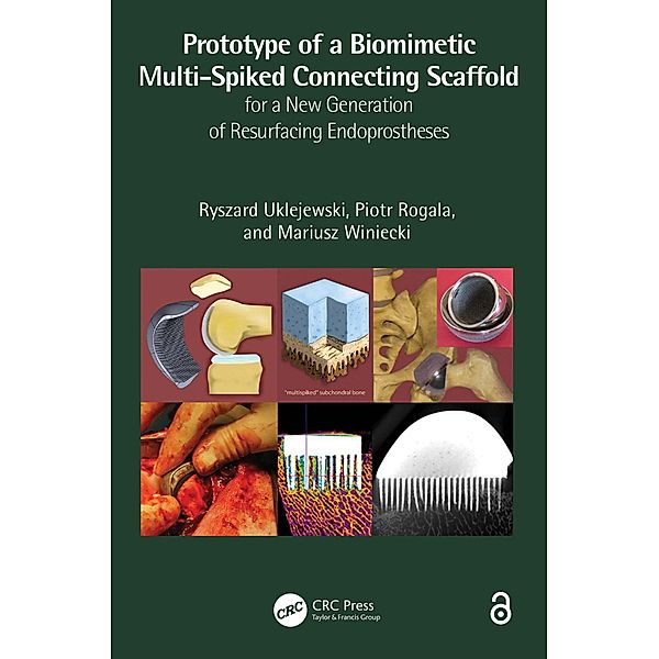 Prototype of a Biomimetic Multi-Spiked Connecting Scaffold for a New Generation of Resurfacing Endoprostheses, Ryszard Uklejewski, Piotr Rogala, Mariusz Winiecki