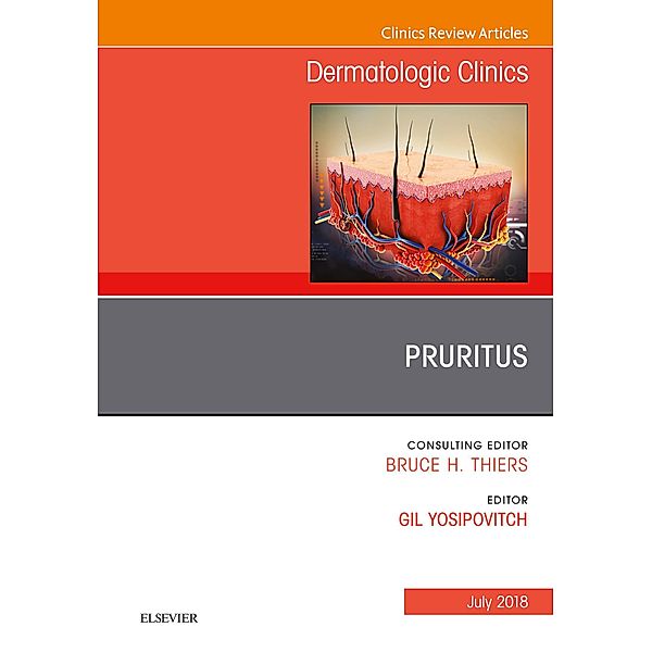 Pruritus, An Issue of Dermatologic Clinics, Gil Yosipovitch