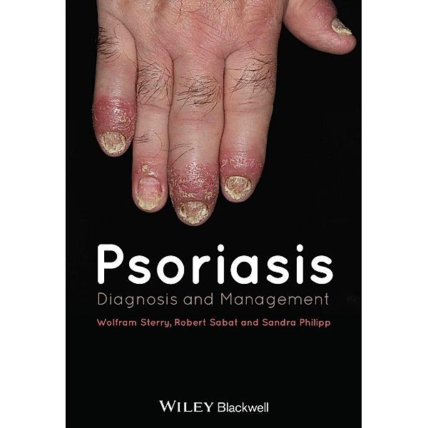 Psoriasis