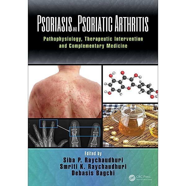 Psoriasis and Psoriatic Arthritis