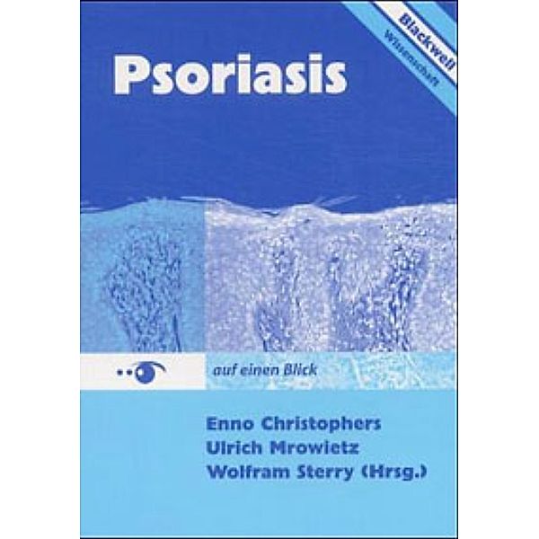 Psoriasis auf einen Blick 3894125470