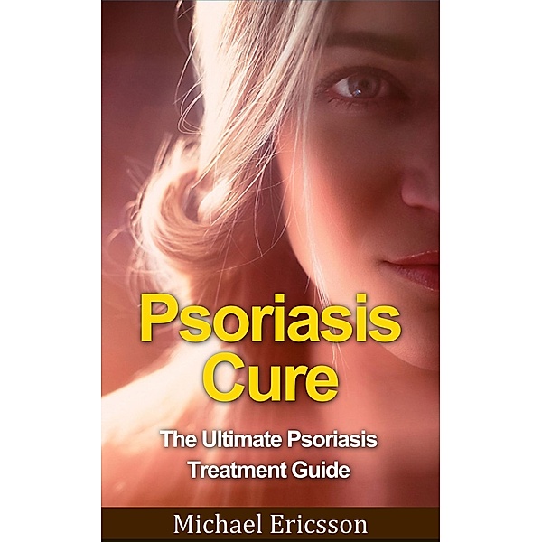 Psoriasis Cure: The Ultimate Psoriasis Treatment Guide, Michael Ericsson