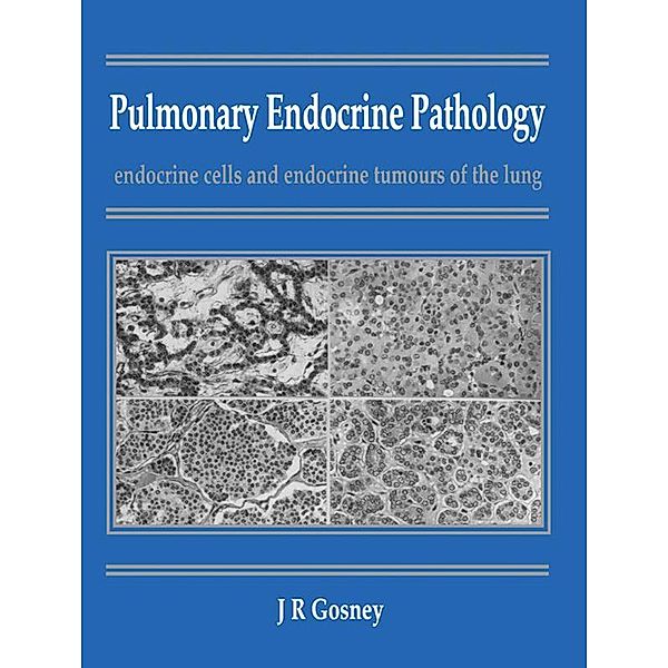Pulmonary Endocrine Pathology, John R. Gosney